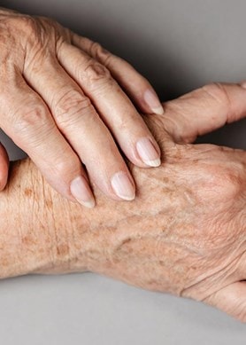 Ältere Person legt eine Hand auf die andere mit Altersflecken Fokus auf Hautgesundheit