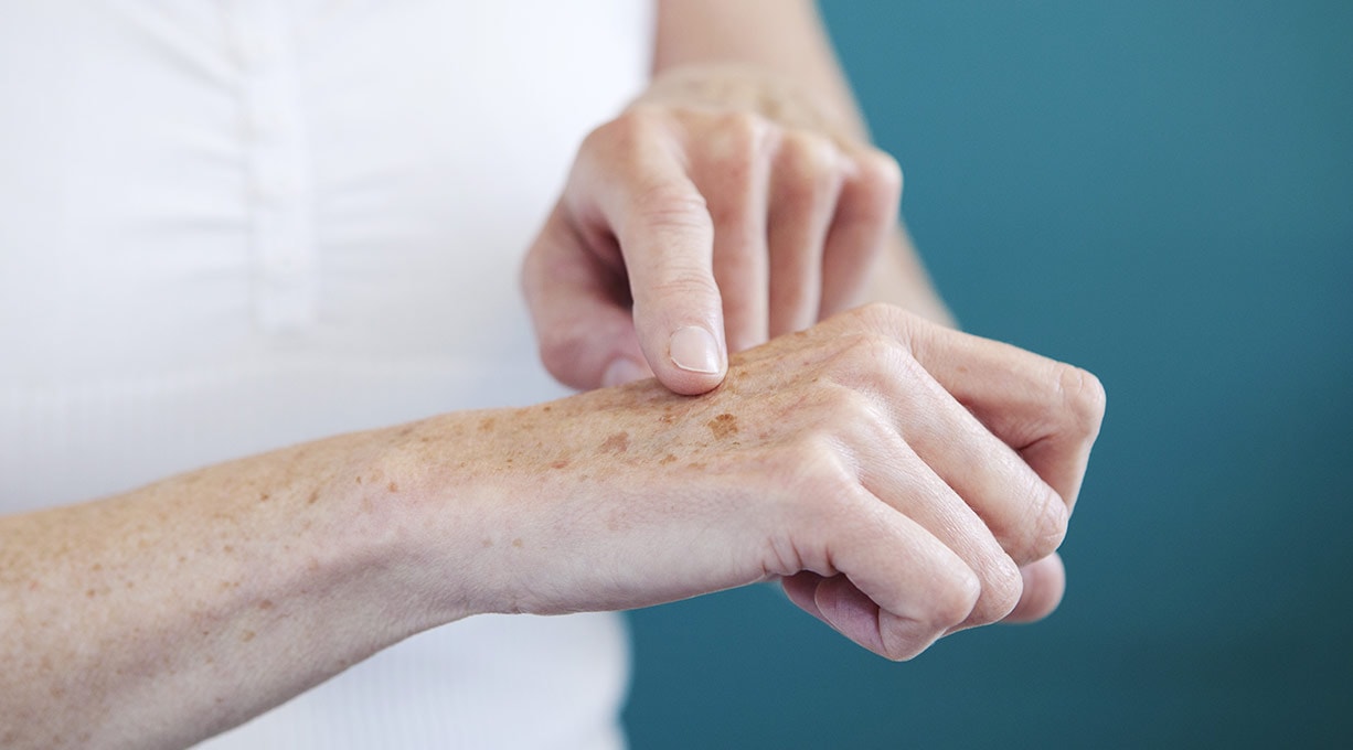Eine Frau berührt mit einer Hand die von Altersflecken gezeichnete Haut der anderen Hand Fokus auf Hautgesundheit