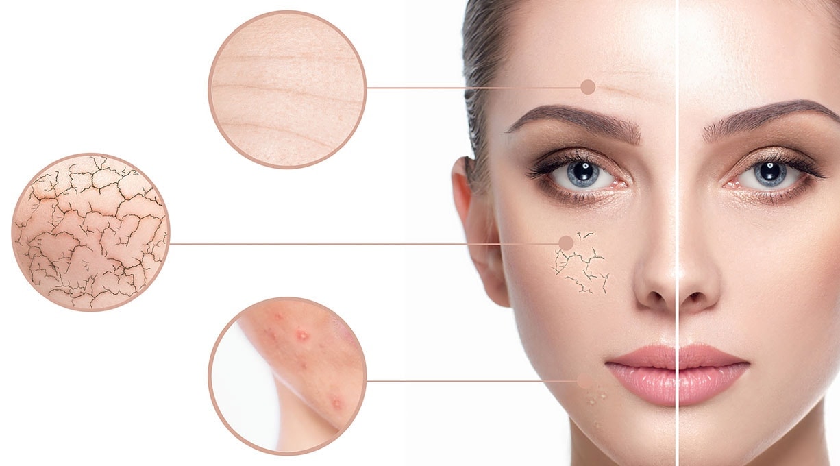 Frauengesicht mit Hautproblemen und vergrößerten Detailaufnahmen