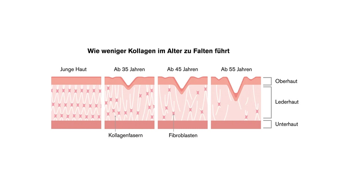 Darstellung des Kollagenverlusts im Alter mit Hautschichten und Faltenentwicklung ab 35 Jahren