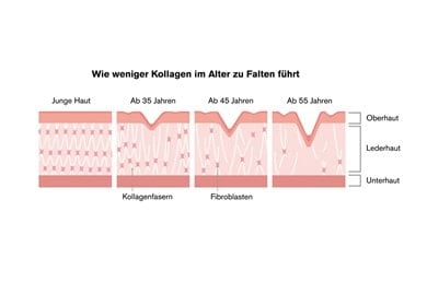 Darstellung des Kollagenverlusts im Alter mit Hautschichten und Faltenentwicklung ab 35 Jahren