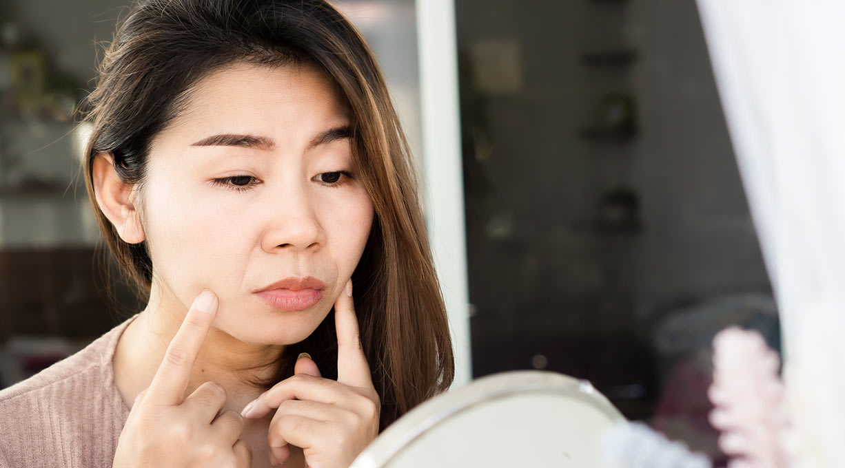 Frau betrachtet ihre ausgeprägten Nasolabialfalten im Gesicht