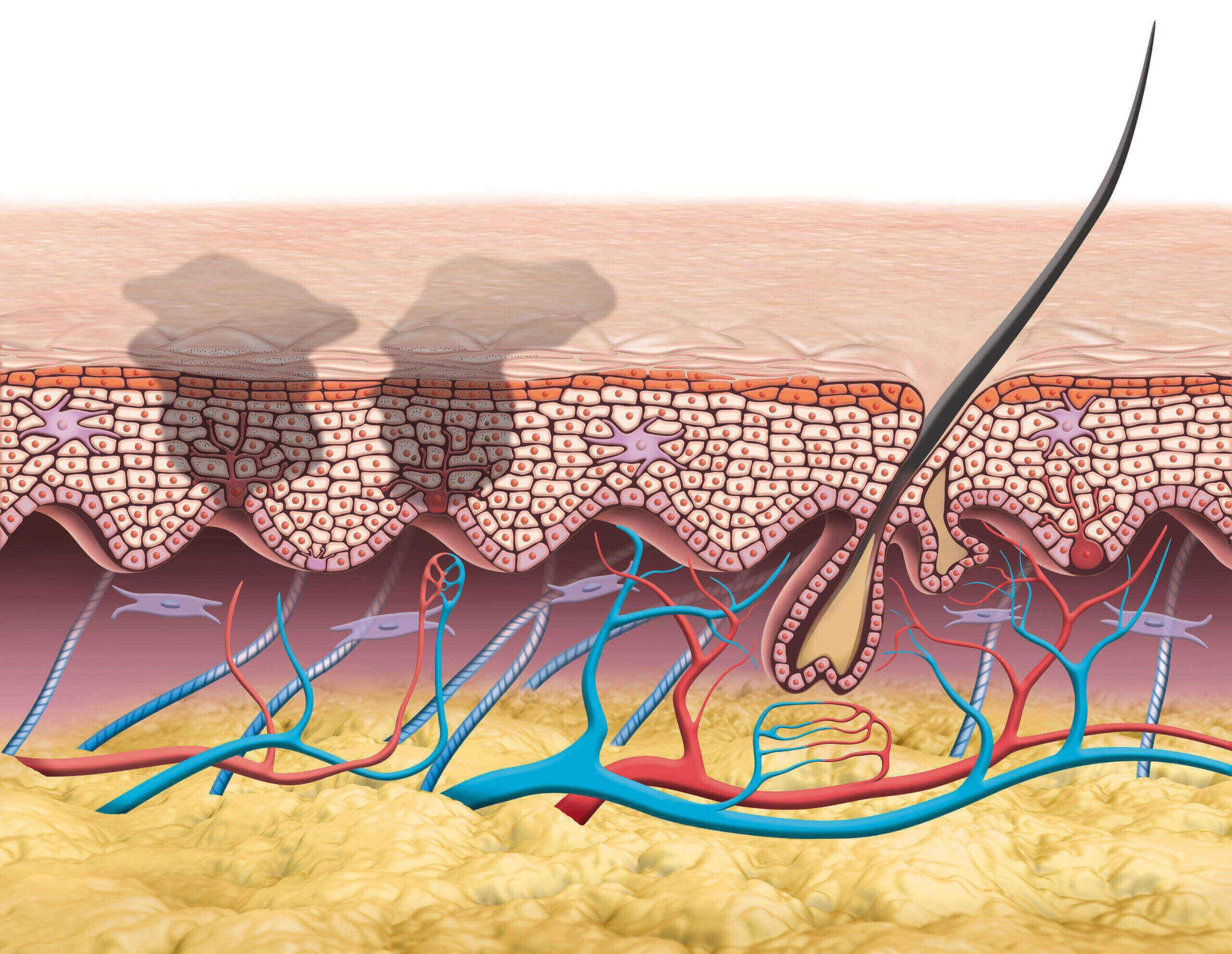 Illustration zeigt Hautquerschnitt mit Pigmentbildung durch UV-Strahlung