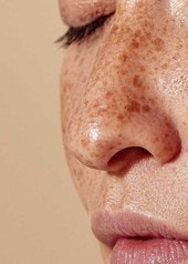 Frau trägt Gesichtscreme auf, Pflege für feuchtigkeitsarme Haut mit Sommersprossen
