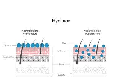 Hochmolekulare Hyaluronsäure und niedermolekulare Hyaluronsäure in den verschiedenen Hautschichten
