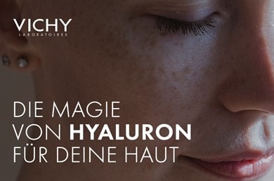 Gesicht mit Sommersprossen einer jungen Frau mit dem Schriftzug „Die Magie von Hyaluron für deine Haut“