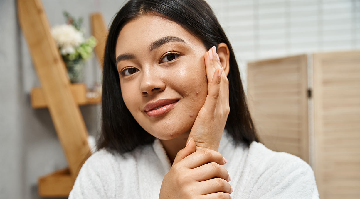 Akne und trockene Haut Header