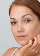 Frau mit Sommersprossen berührt leicht ihr Gesicht