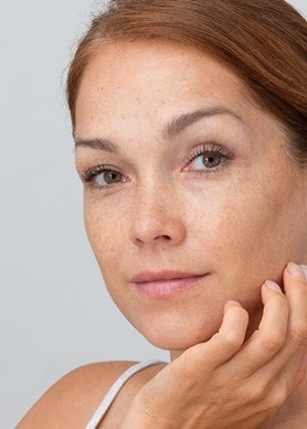 Frau mit Sommersprossen berührt leicht ihr Gesicht