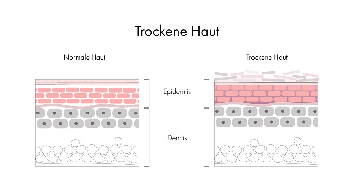 Hautschichten im Vergleich bei normaler und trockener Haut