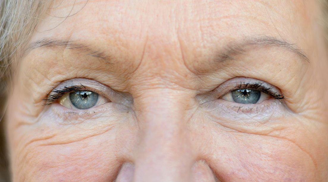 Nahaufnahme der Augenpartie einer älteren Frau mit sichtbaren Falten