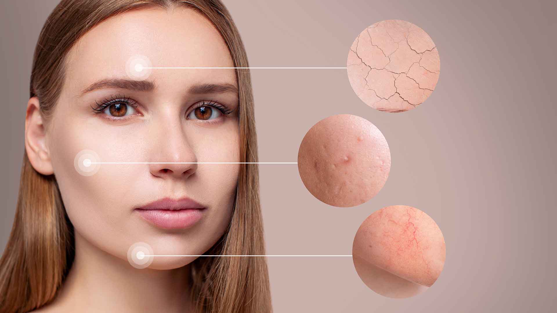 Gesicht einer jungen Frau mit Fokus auf verschiedene Hautprobleme wie trockene Stellen, Unreinheiten und Rötungen