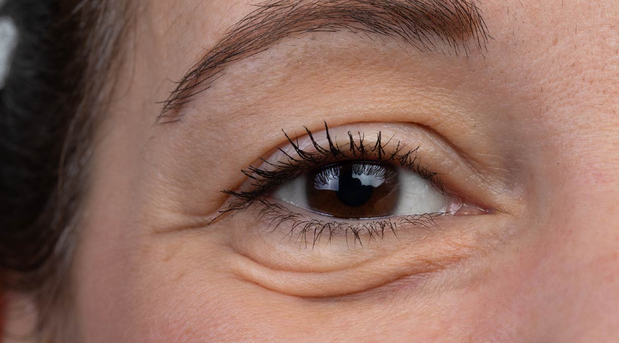 Braunes Auge einer Frau mit Tränensäcken