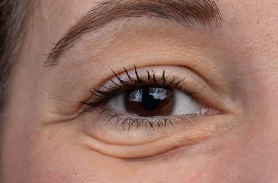 Braunes Auge einer Frau mit Tränensäcken