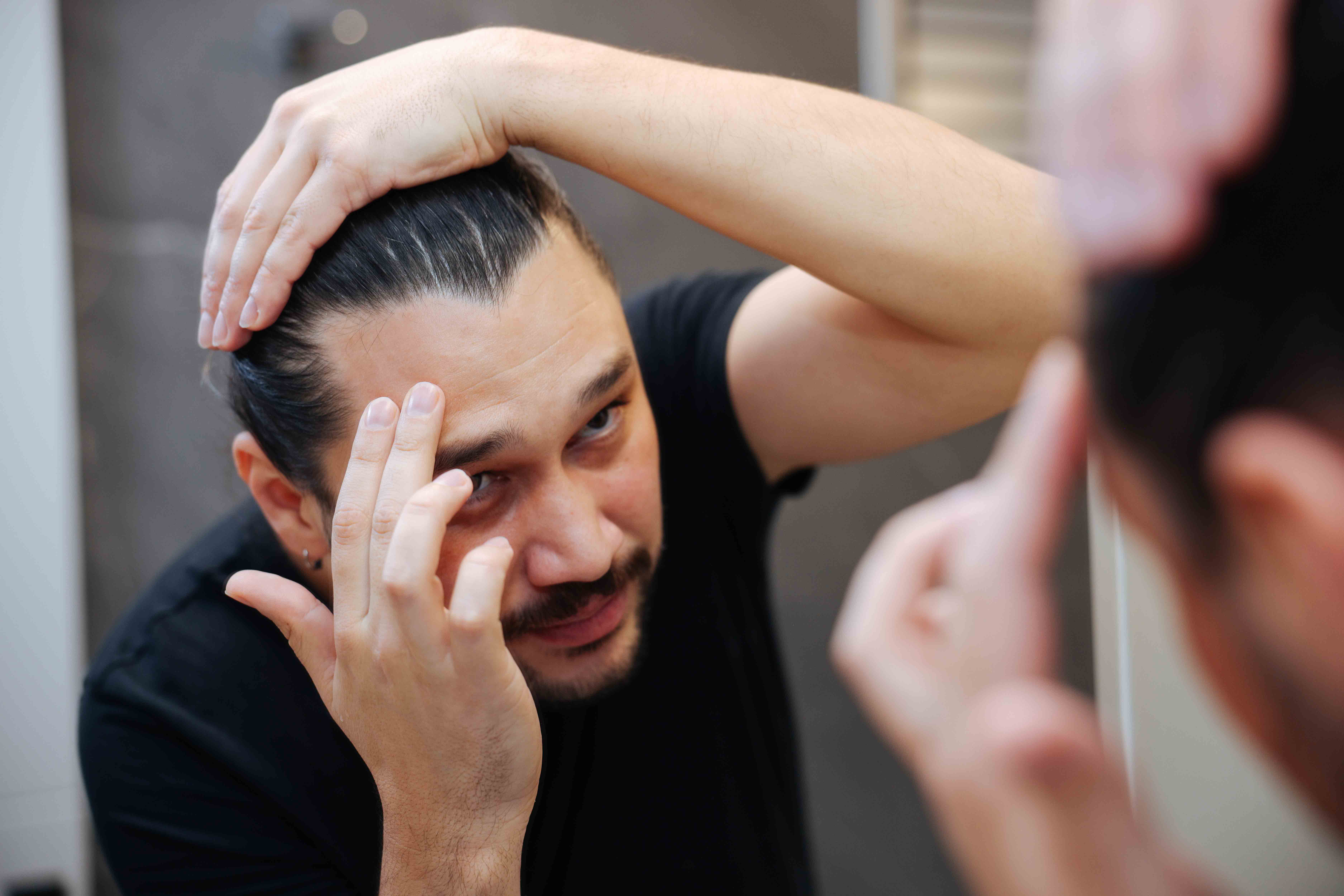 Mann betrachtet im Spiegel seinen Haaransatz und prüft möglichen Haarausfall im Badezimmer