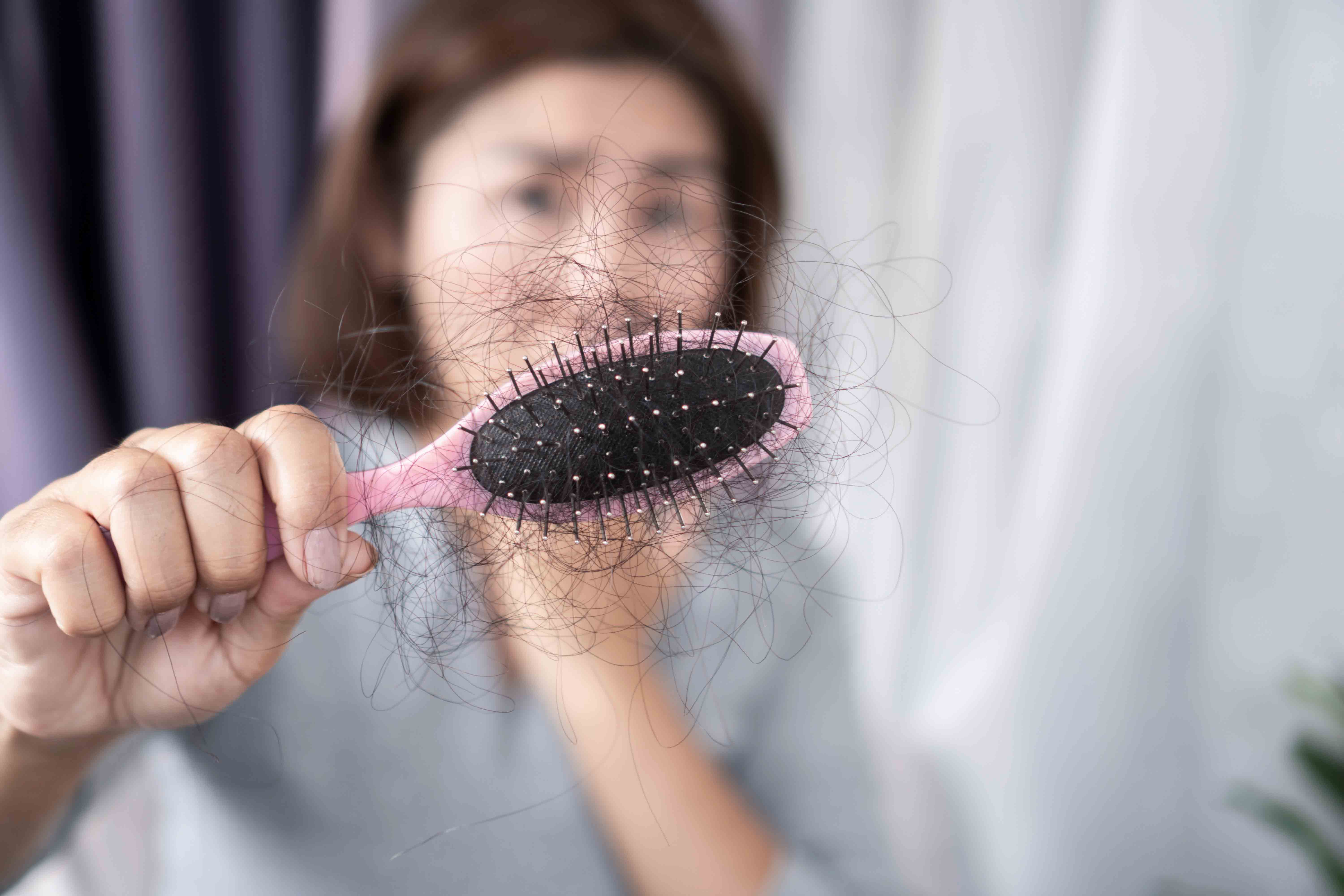 Frau hält Haarbürste mit ausgefallenen Haaren in die Kamera