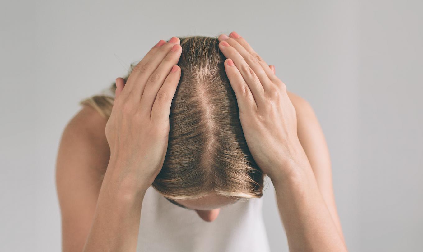 Frau hält sich mit beiden Händen den Kopf; der Scheitel weist auf Haarverlust hin