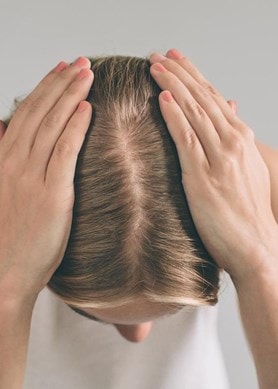 Frau hält sich mit beiden Händen den Kopf; der Scheitel weist auf Haarverlust hin