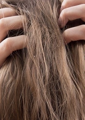 Frau mit langen, dunkelblonden Haaren von hinten kratzt sich an der Kopfhaut
