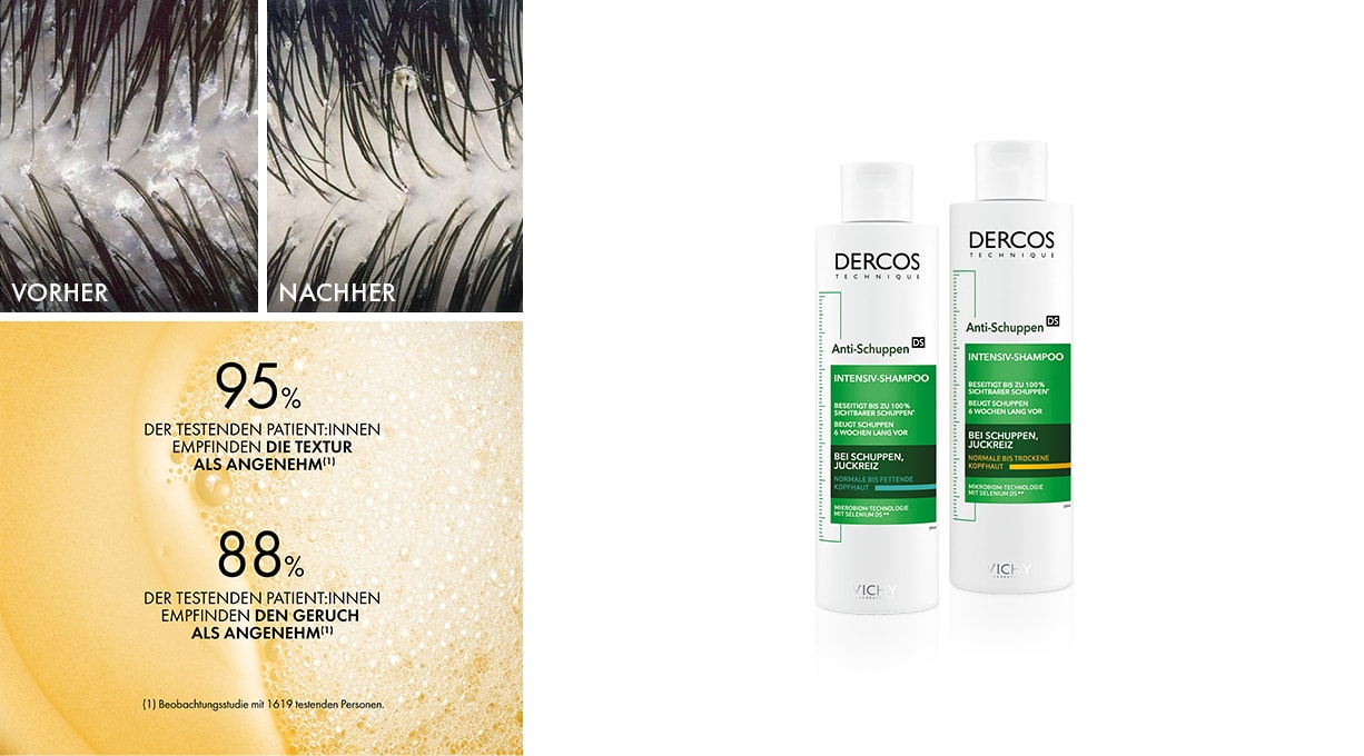 Vichy Produkte gegen Schuppen