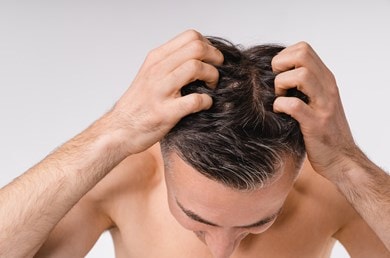 Mann mit dunklen Haaren von oben, der mit den Fingerspitzen seine Kopfhaut kratzt