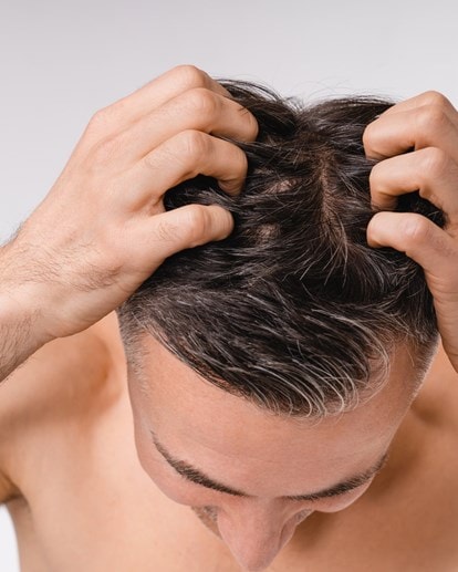 Mann mit dunklen Haaren von oben, der mit den Fingerspitzen seine Kopfhaut kratzt