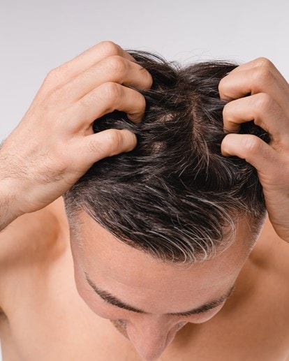 Mann mit dunklen Haaren von oben, der mit den Fingerspitzen seine Kopfhaut kratzt