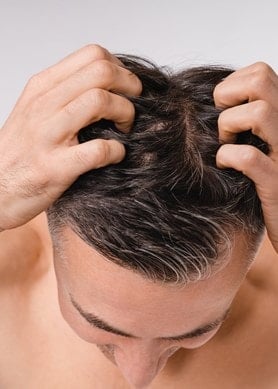 Mann mit dunklen Haaren von oben, der mit den Fingerspitzen seine Kopfhaut kratzt