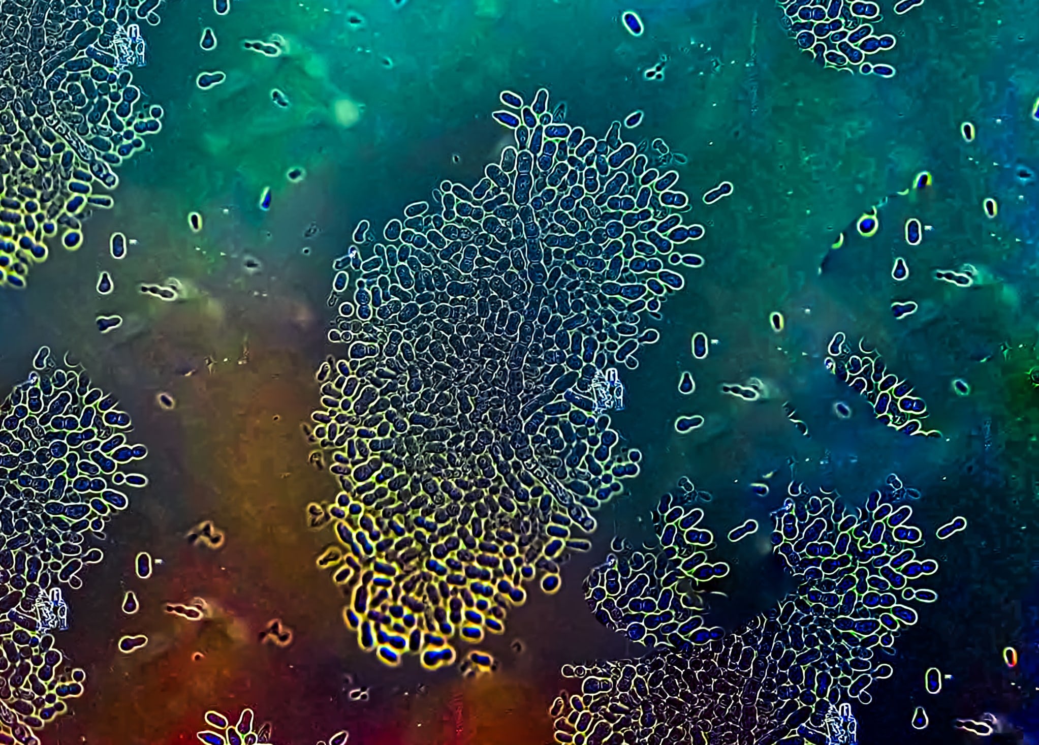 Hefepilz Malassezia furfur unter dem Mikroskop