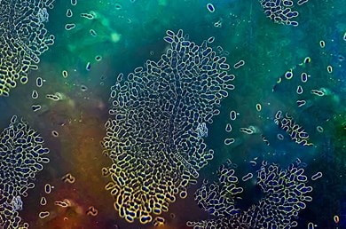 Hefepilz Malassezia furfur unter dem Mikroskop