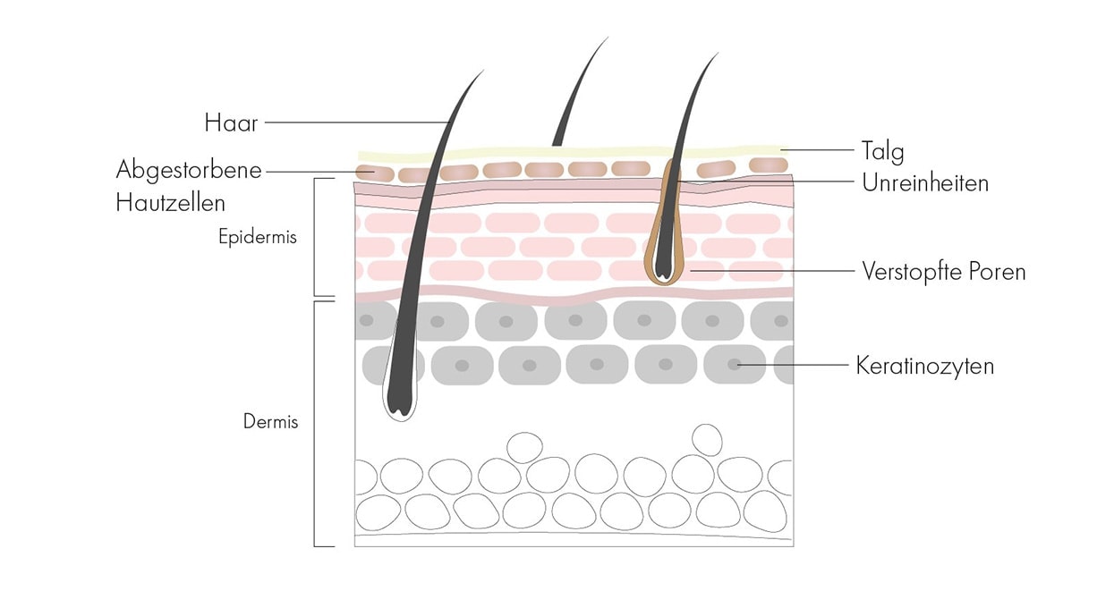 Grafik mit dem Aufbau der obersten Hautschicht