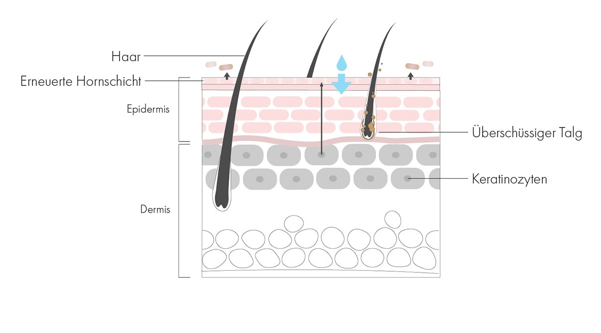 Grafik mit der natürlichen Zellerneuerung der Haut