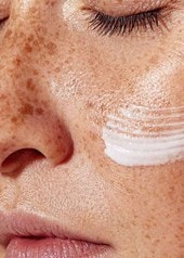 Nahaufnahme einer Sommersprosse-Haut mit aufgetragener Sonnencreme unter dem Auge