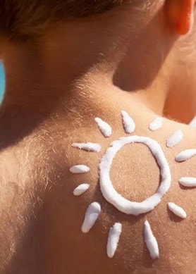 Aufnahme des Rücken eines Kindes auf dessen Schulter eine Sonne mit Sonnencreme gemalt wurde.