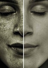 Sonnenschutz und AntiAging