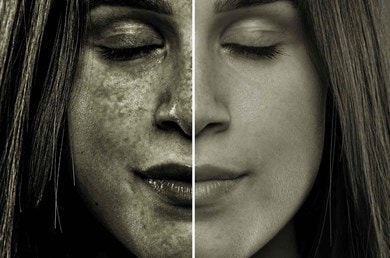 Sonnenschutz und AntiAging