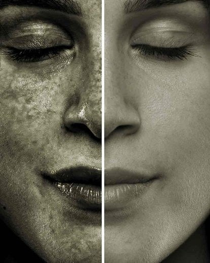 Sonnenschutz und AntiAging