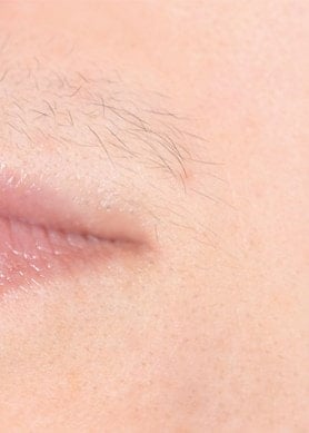Lippenpartie einer Frau mit erkennbarer Gesichtsbehaarung über der Oberlippe