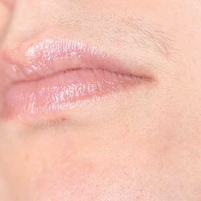 Lippenpartie einer Frau mit erkennbarer Gesichtsbehaarung über der Oberlippe