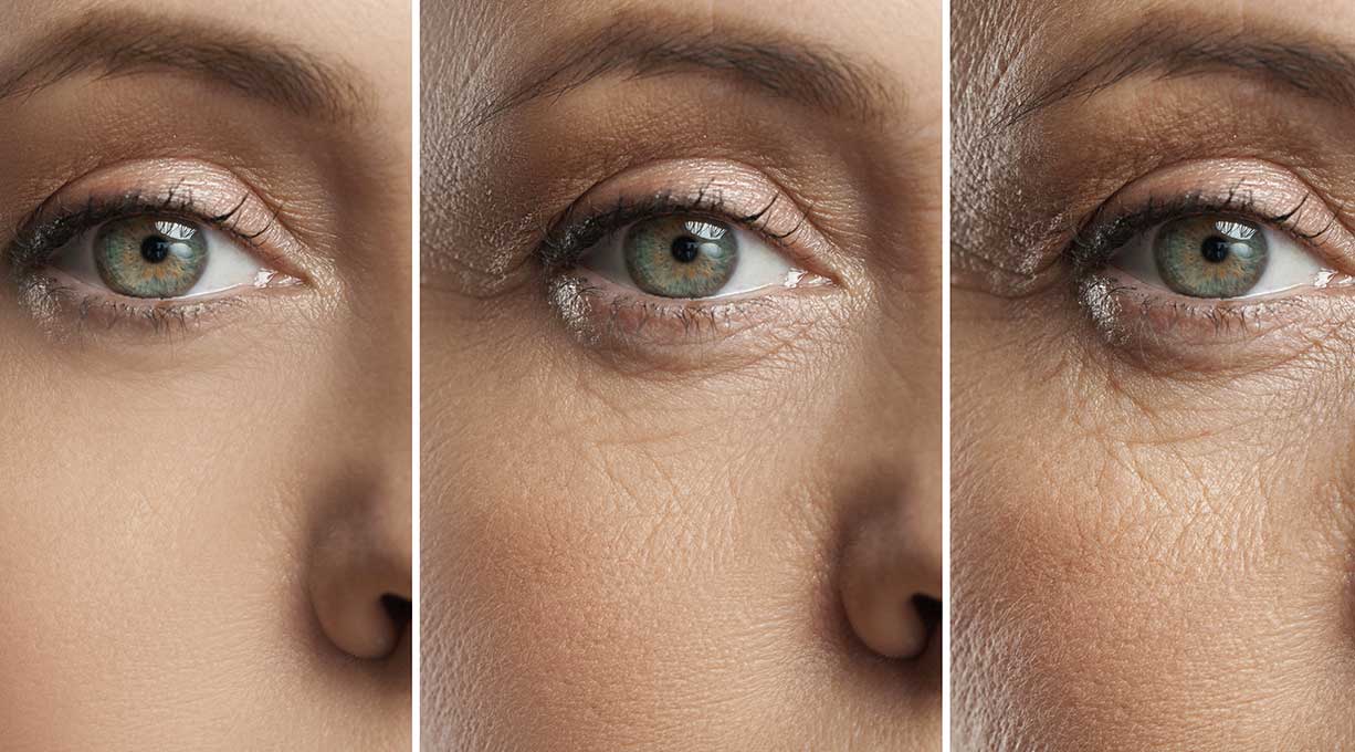 Beeinflussung der Haut durch Stress