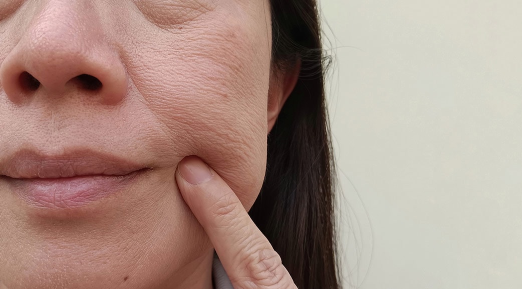 Wangenpartie einer Frau mit trockener Haut, die sich mit dem Zeigefinger berührt