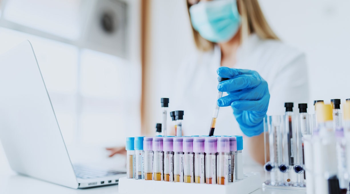 Loreal als Vorreiter