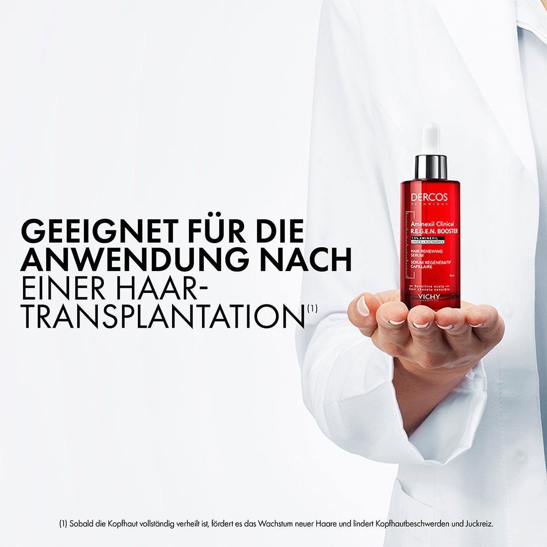 Das Serum ist geeignet für die Anwendung nach einer Haar-Transplantation