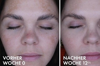 Vichy Liftactiv B3 Anti-Pigmentflecken Nachtcreme Before and After V4