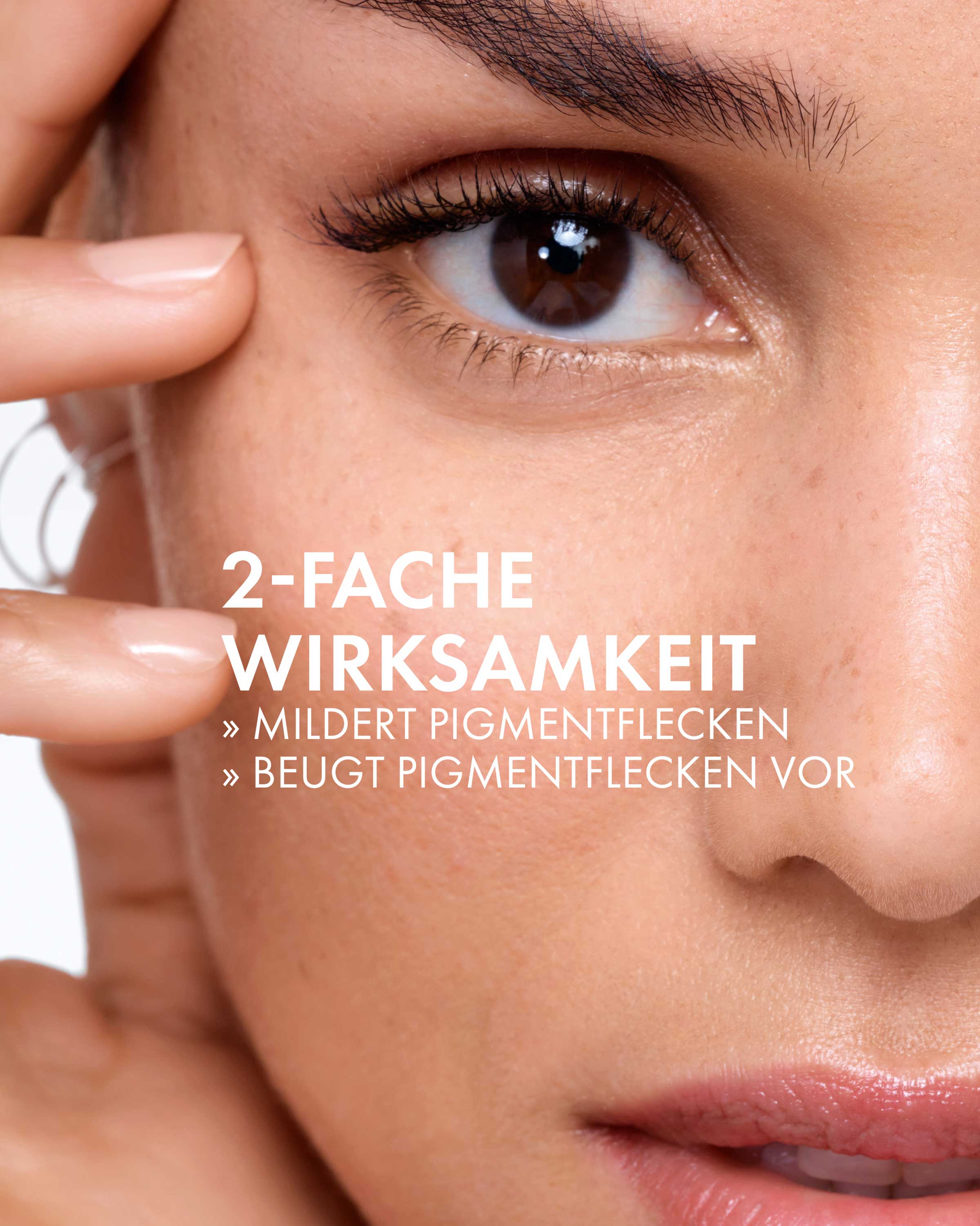 Epiglow Melanex Anti-Pigmentflecken Creme – 2 Stück, Für Ebenmäßigeren, Strahlenden Teint